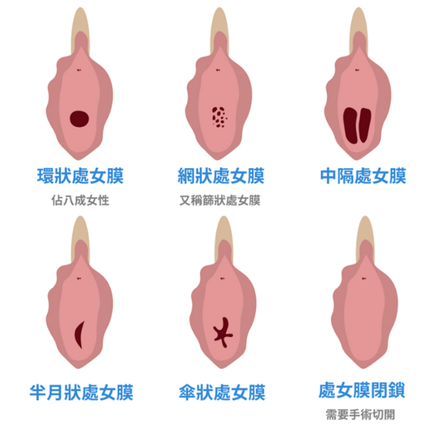 关于那层“膜”，你了解多少？